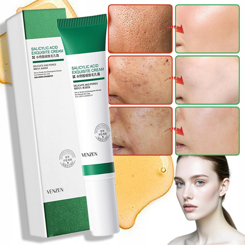 TEMU 20ml Salicylic Acid Emulsion, Moisturizing And Gentle For Cleansing And Balancing, For Women And Men, Day And Night