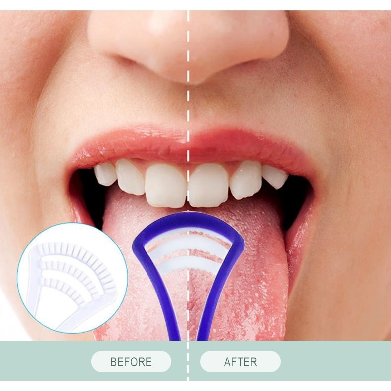 4pcs Multicolour Durable Tongue Scraper Set