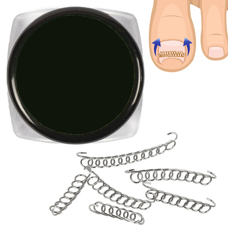 Ingrown Toenail Correction Clip Set